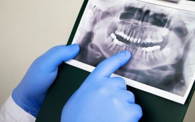 Understanding Who An Endodontist Is.￼